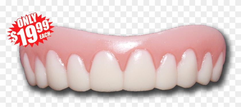 598 Large Image - Instant Smile Upper Teeth Clipart #10606