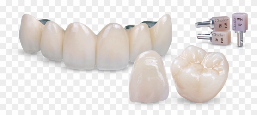 Obsidian Ceramic Restorations - Corona En Porcelana Png Clipart
