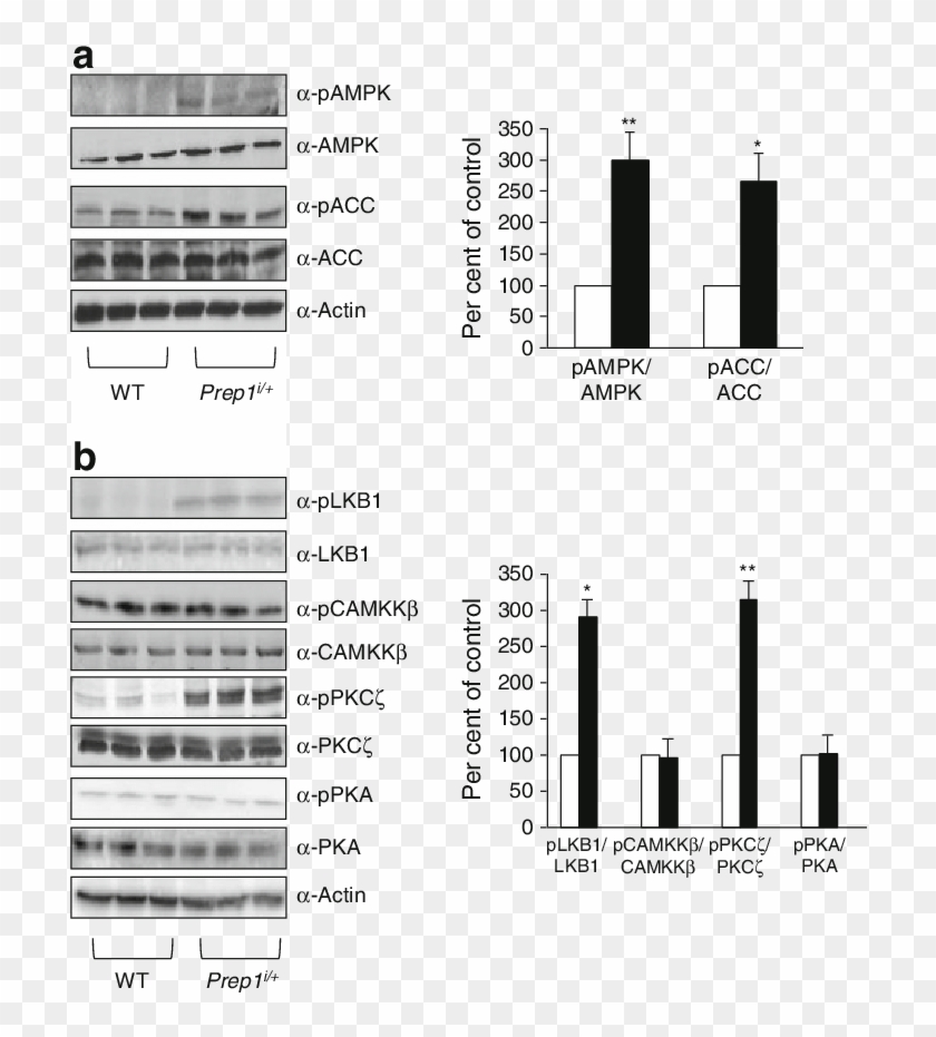 Liver Tissue From Prep1 I/ And Control - High Fat Diet Ampk Acc Liver Clipart #1014416