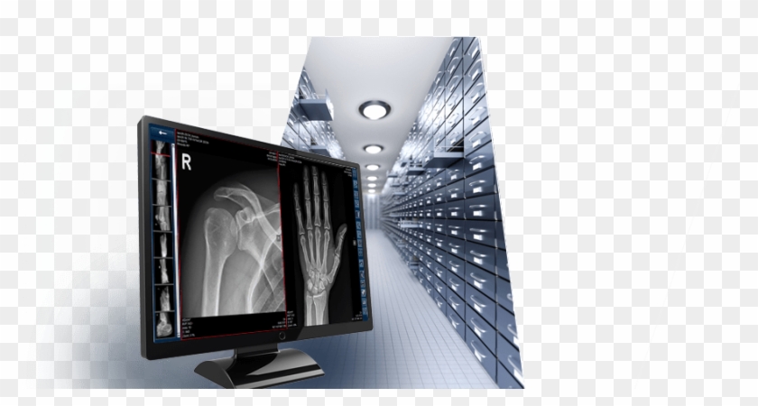 Dicom Cloud Orca - Lcd Tv Clipart #1055258