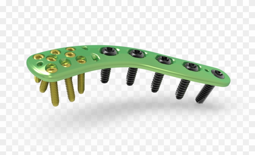 See All Images - Distal Clavicle Plate Clipart