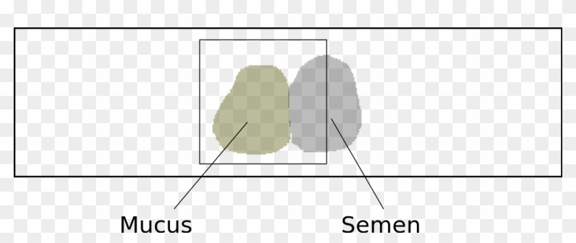 Miller Kurzrok Test Clipart