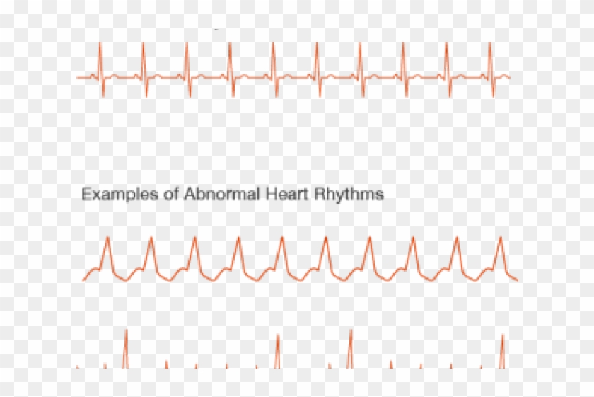 Peach Clipart #1113932