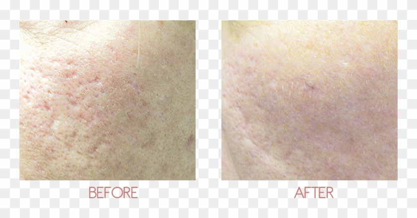 About - Scar Clipart #1135039