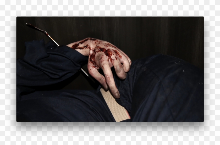 #ncis Evidence Files - Injury Clipart