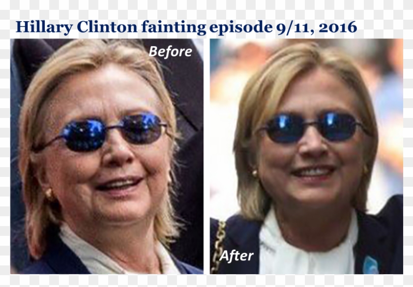 Images From Www - Anti Seizure Zeiss Z1 Clipart