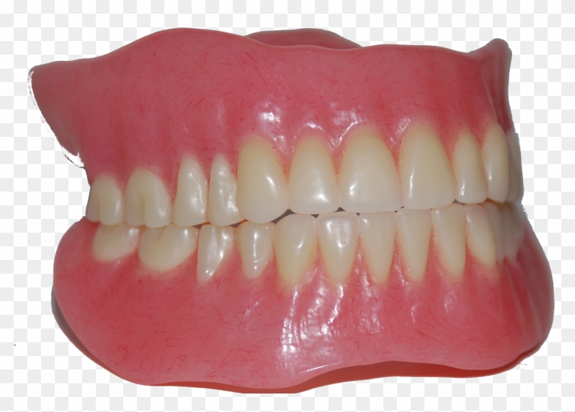 Free Download Teeth - Dental Denture Png Clipart #1211238