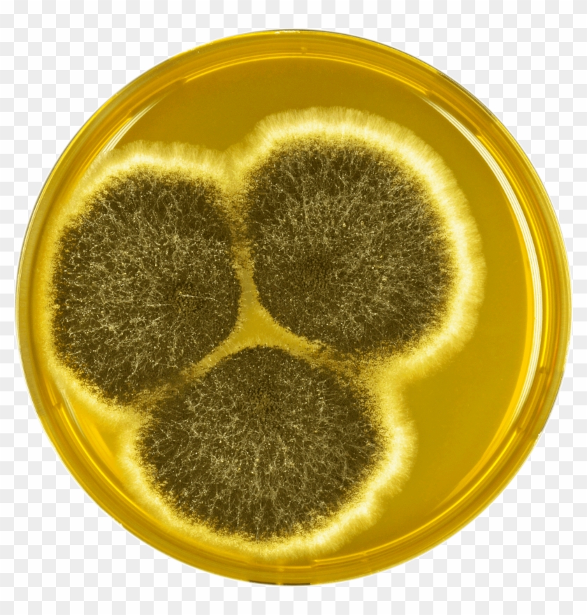 Aspergillus Neoniger Meaox - Aspergillus Eucalypticola Clipart #1230305