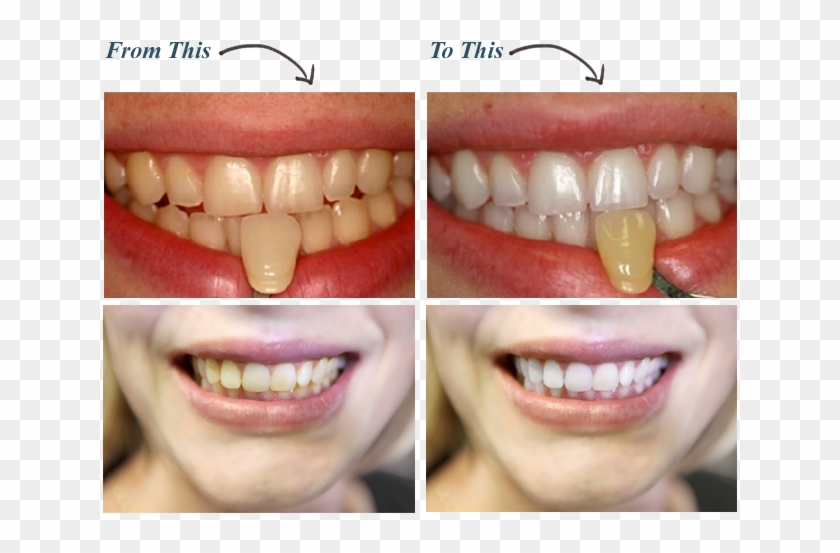 Dentist In Savannah Ga Dental Solutions Common - My Teeth White Clipart #1254188