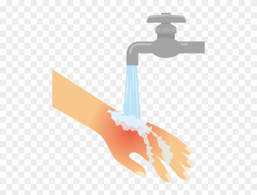 After The Burn Has Been Cooled, Cover It With Cling - Burn Cartoon Clipart