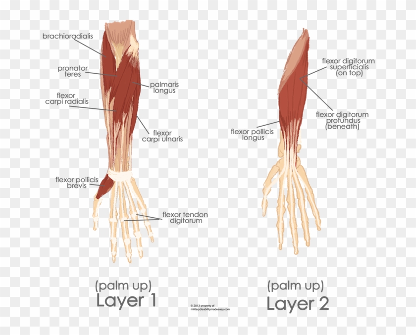 The Muscles Of The Hand And Forearm - Flexor Carpi Ulnaris And Flexor Digitorum Profundus Clipart