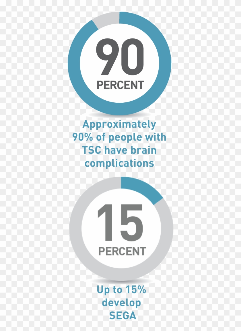 Segas Usually Develop During Childhood But They Can - Accent Jobs Clipart #137583