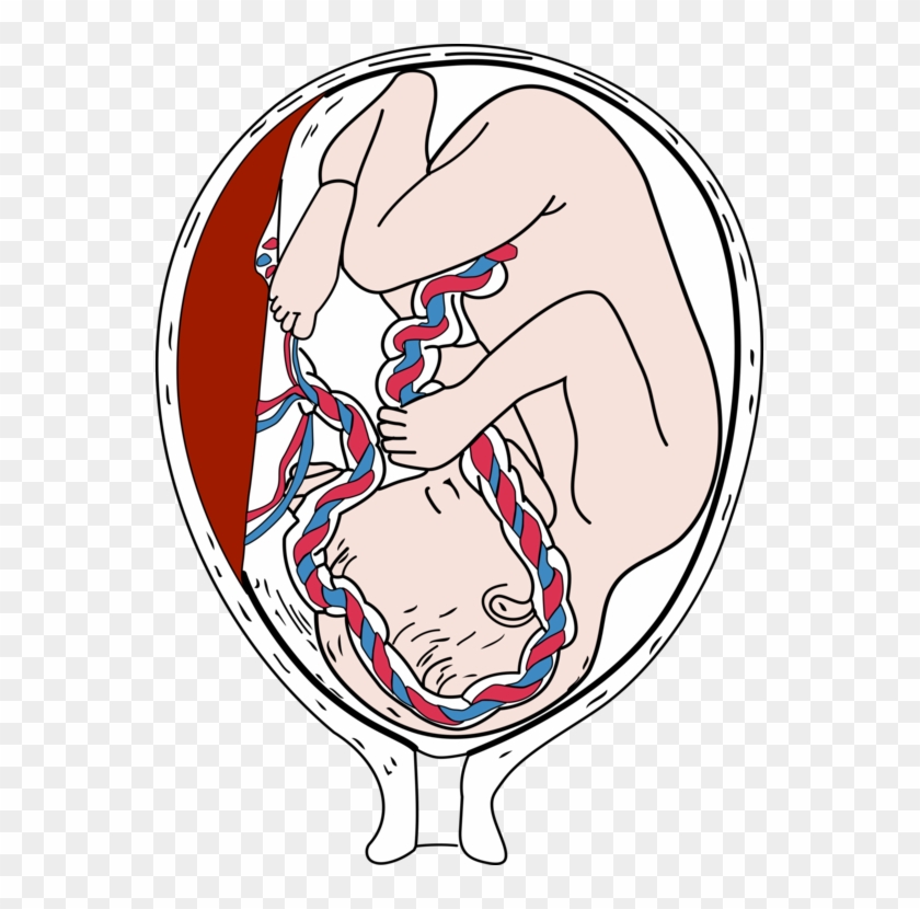 Fetus Placenta Pregnancy Infant Embryo - Placenta Clipart - Png Download
