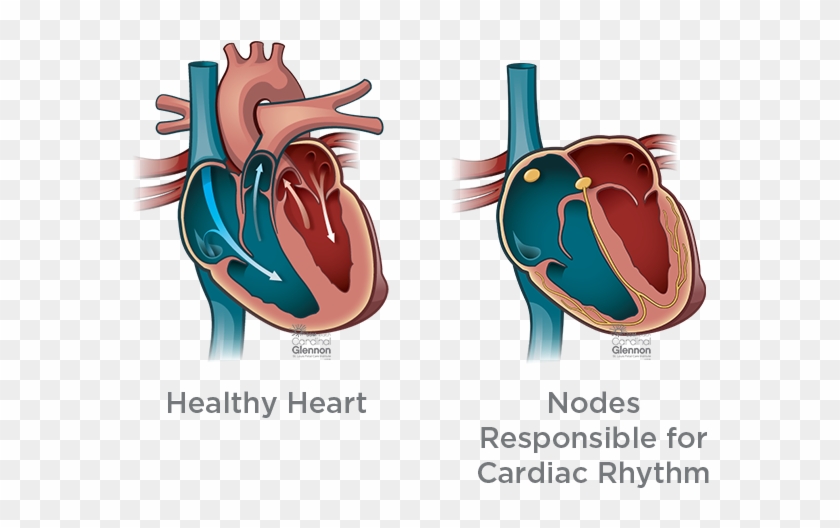 Fetal Arrhythmia - Children’s Healthcare Of Atlanta Clipart