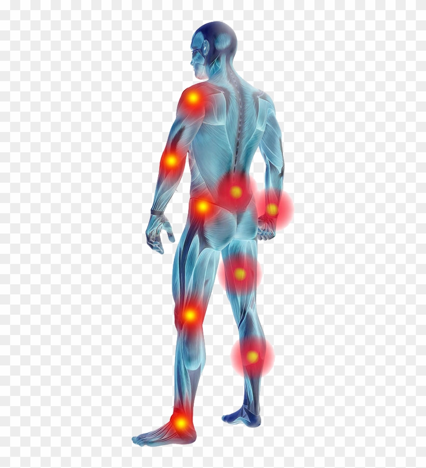 Muscle Pain Remedies - Muscle Pain And Transparent Clipart