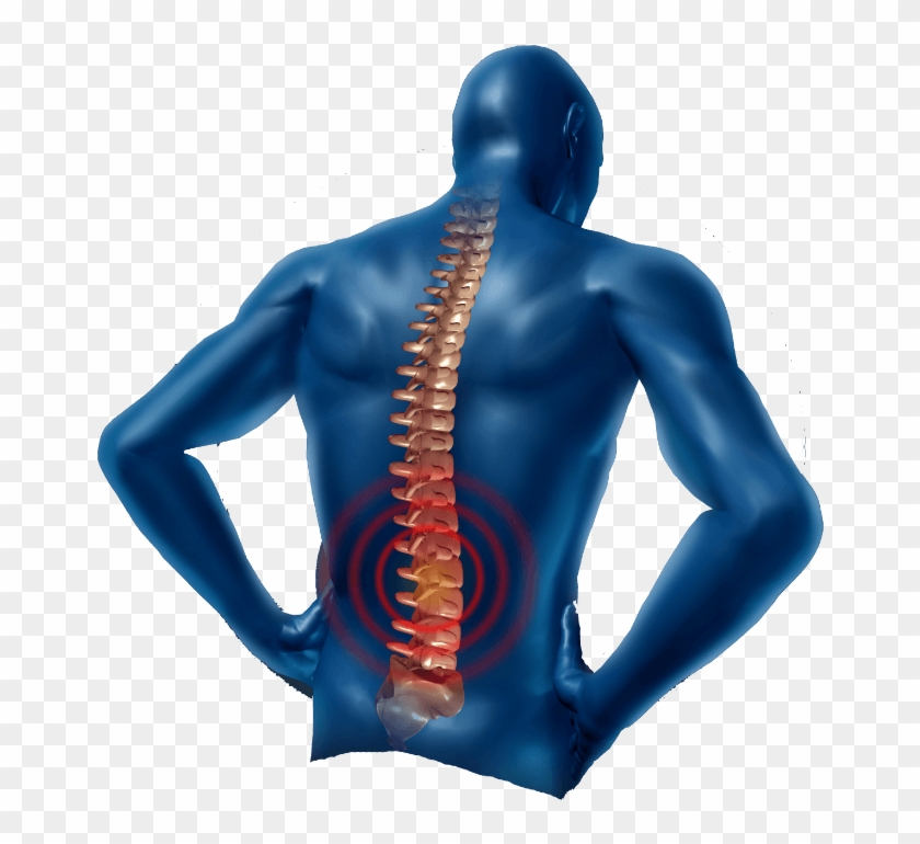 Pain In The Neck Png Transparent Image - Lower Back Pain Png Clipart #1316078