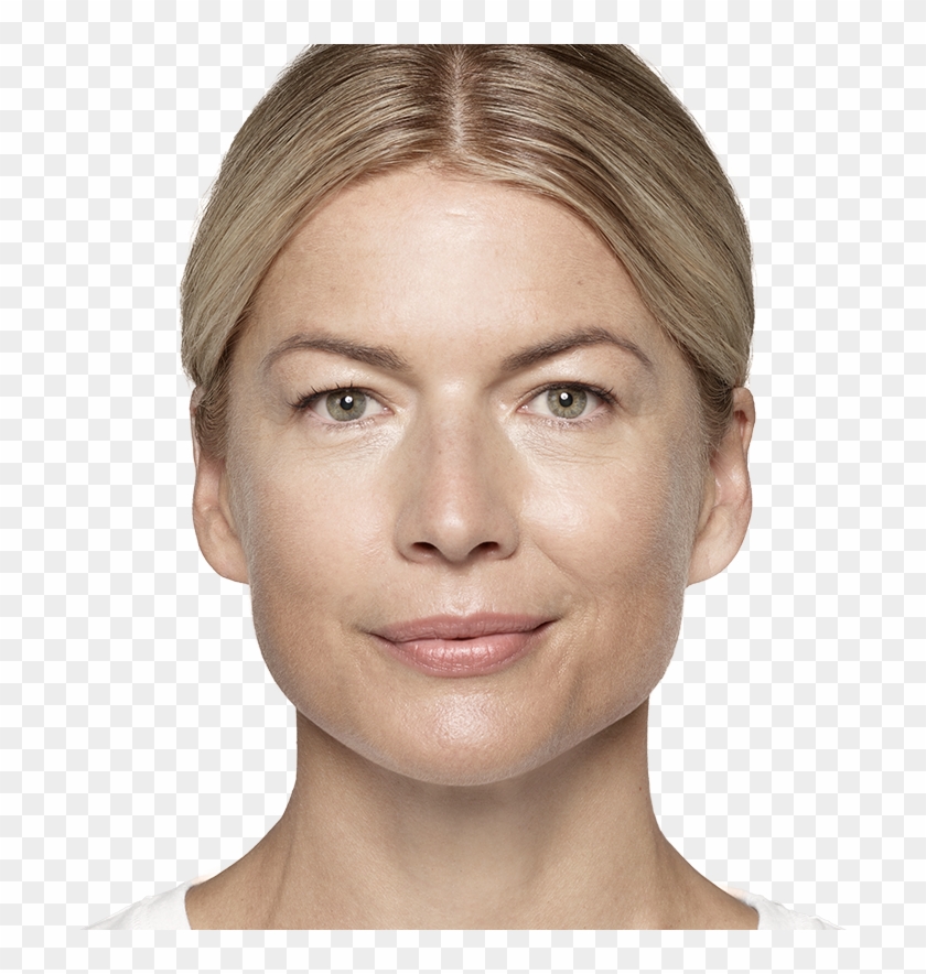 Graphic-hero - Liquid Lift Restylane Clipart