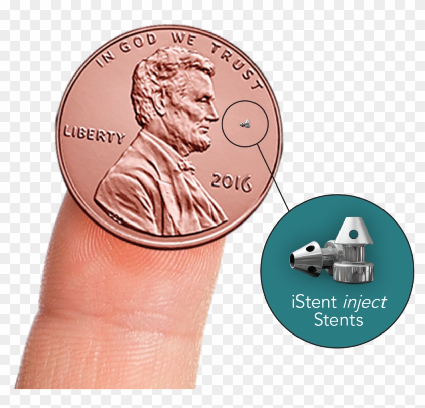 Istent On Penny - Istent Glaucoma Clipart #142150