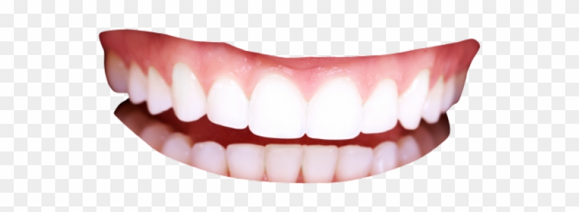 640 X 480 5 - Human Teeth Png Clipart #142261