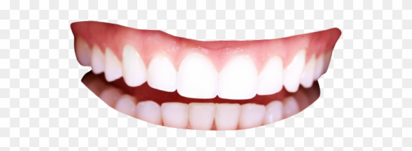 640 X 480 5 - Human Teeth Png Clipart
