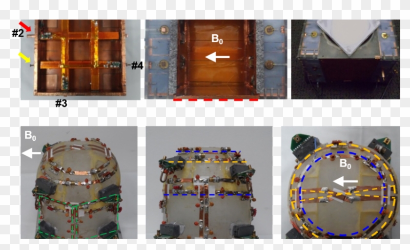 7t Tic Tac Toe Breast Coil System - Circle Clipart #1406078