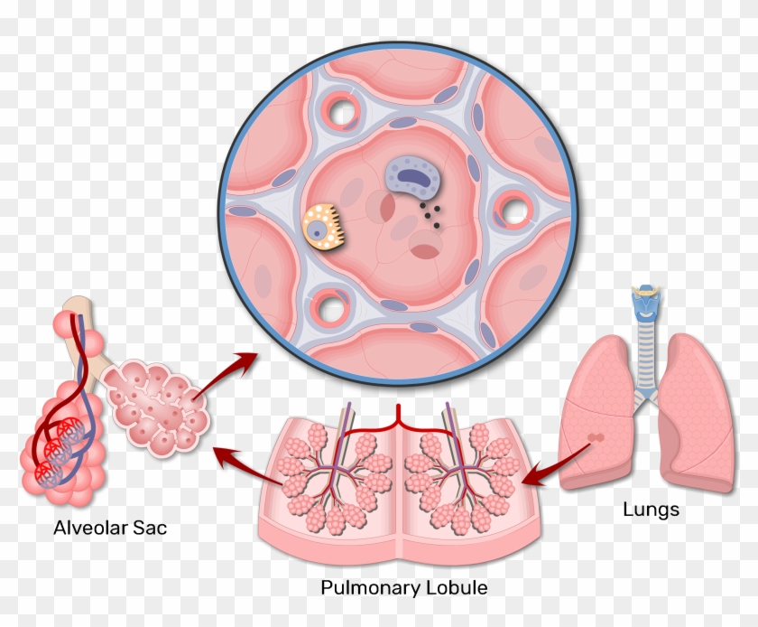 A Magnified View Of An Alveolar Sac - Alveoli Structure Clipart #1408882