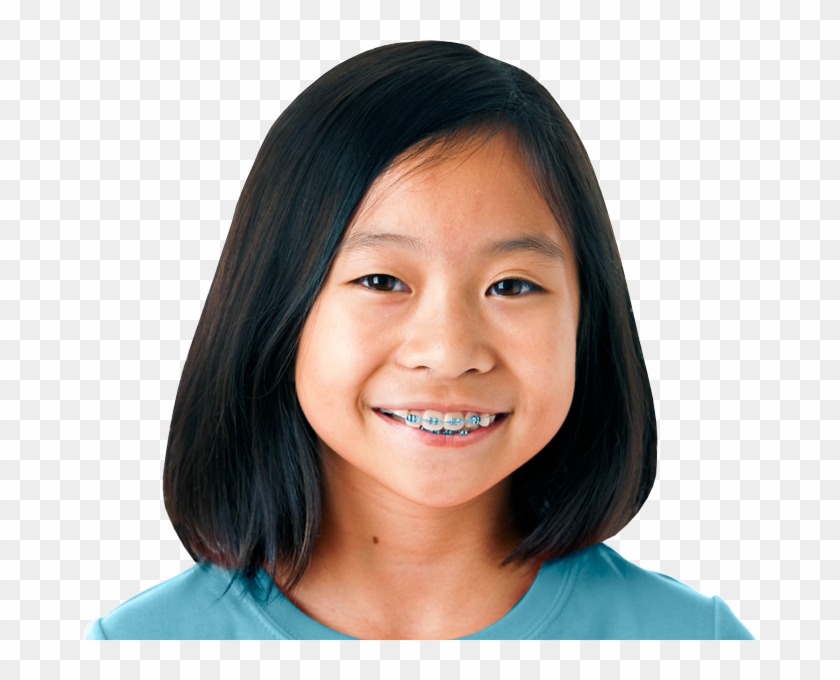 Girl-braces - Girl Braces Transparent Png Clipart