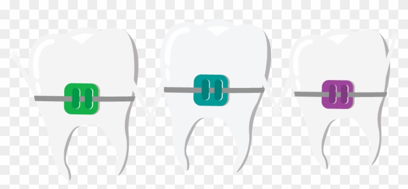 Colored-braces Clipart #1416429