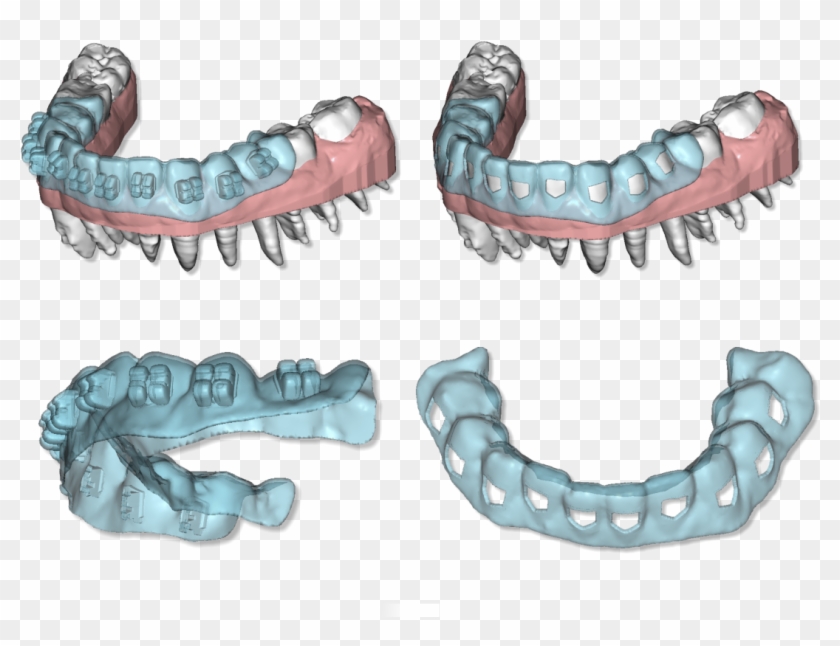 File - Maestro3d - Dental - Studio - Clear - Aligner - Maestro Ortho Studio Clipart