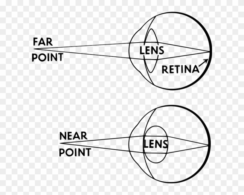 How The Lens Focusses Light - Accommodation Eye Clipart #1463970