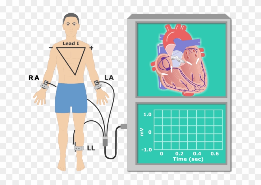 The P Wave Ekg Recording Animation Slide - Electrocardiogram Cartoon Clipart