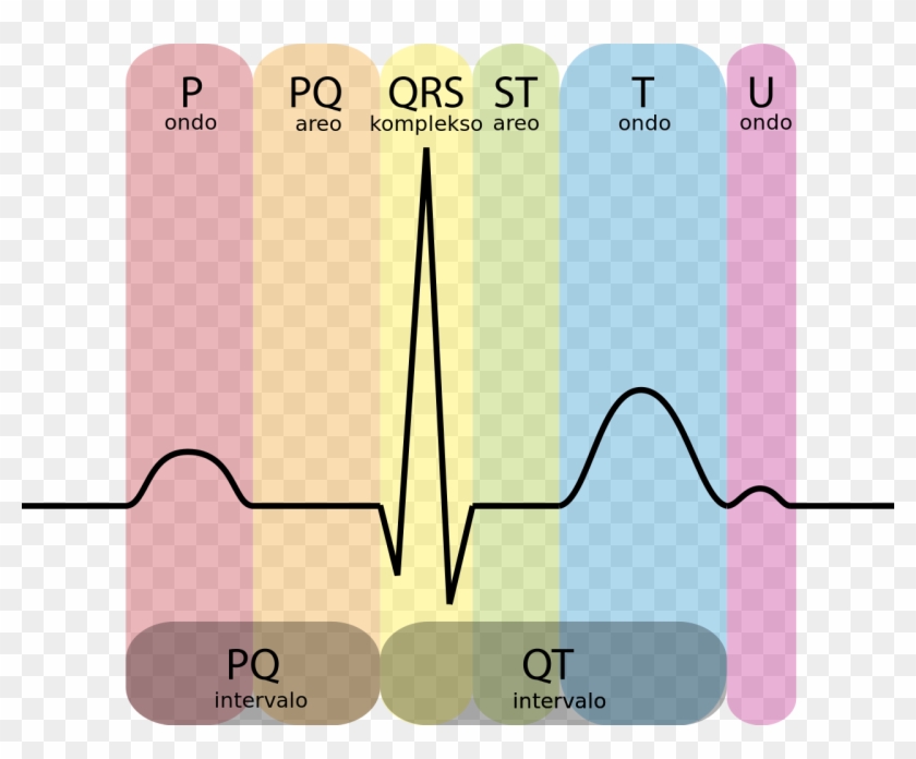 File - Ekg-komplekso Eo - Svg - Conduction System Of The Heart Ecg Clipart #1494419