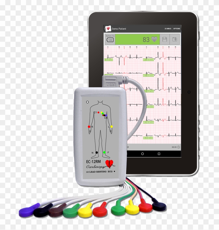Ec-12rm Cardiospy Mobile For Android 12 Channel Resting - Ecg Mobile Clipart #1495454