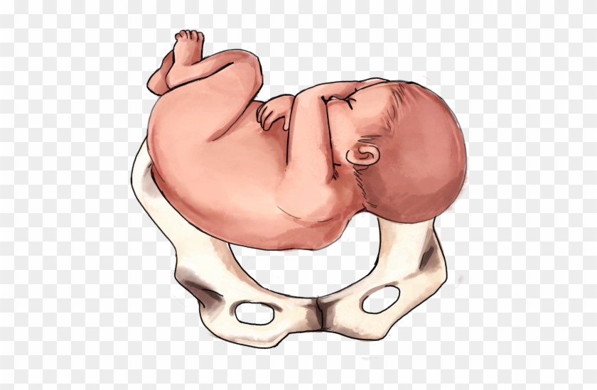 Transverse Baby - Baby's Position In Womb At 6 Months Clipart #1527996