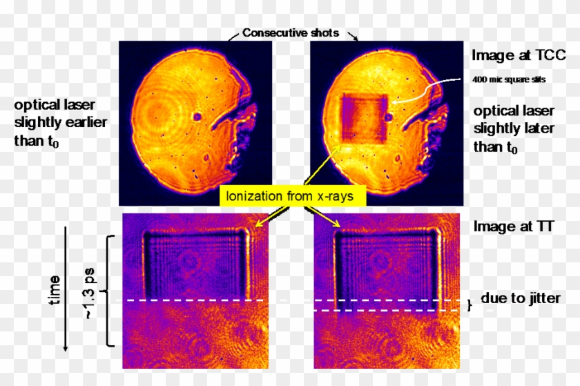 Synchronization Of Laser To The X-ray The Time Tool - Art Clipart