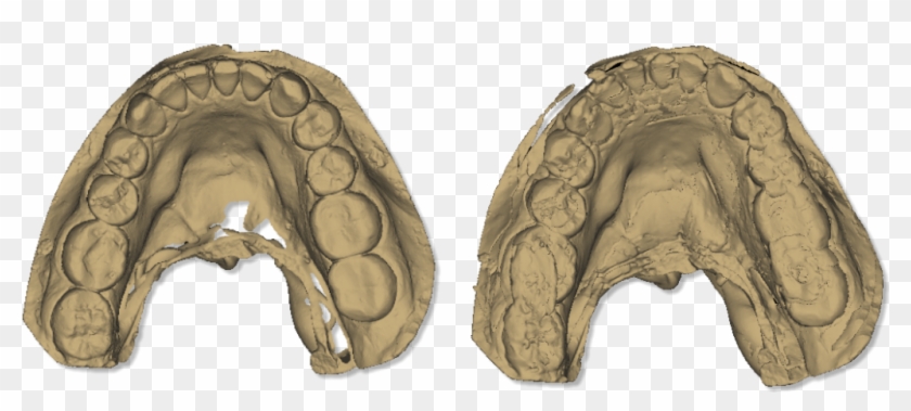 File - Maestro - 3d - Easy - Dental - Scan - Calibration - Scanner 3d Dentale Clipart