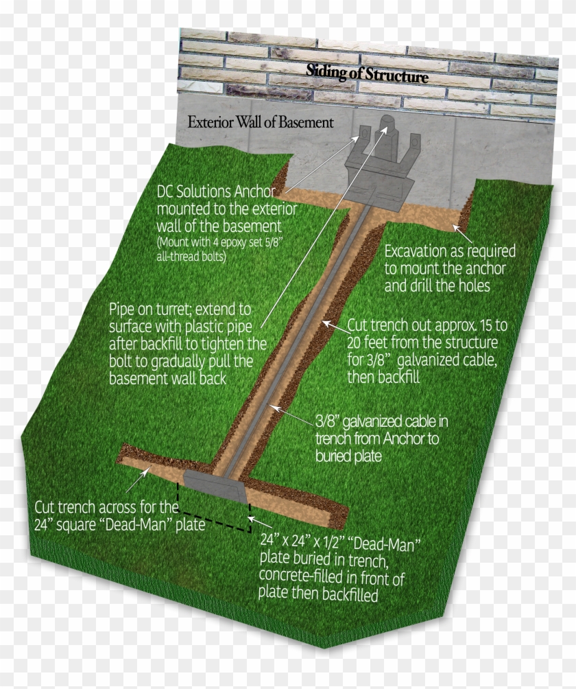 Bowing Walls - Dead Man Anchor Wall Clipart