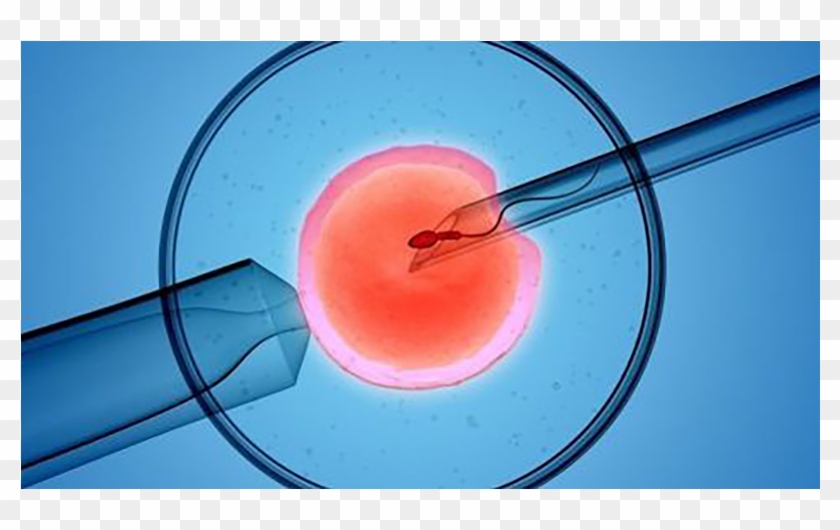 Ivf Possible Despite A Semen Report Showing Dead Sperm - Ivf Clipart