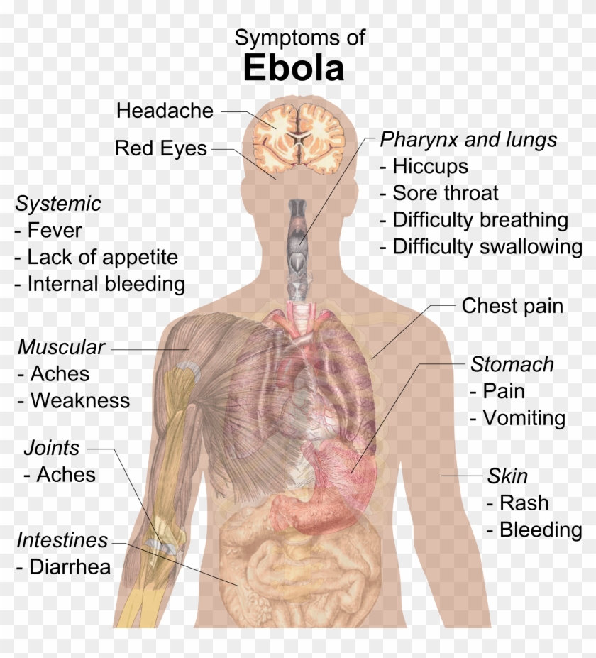 Symptoms Of Ebola Clipart