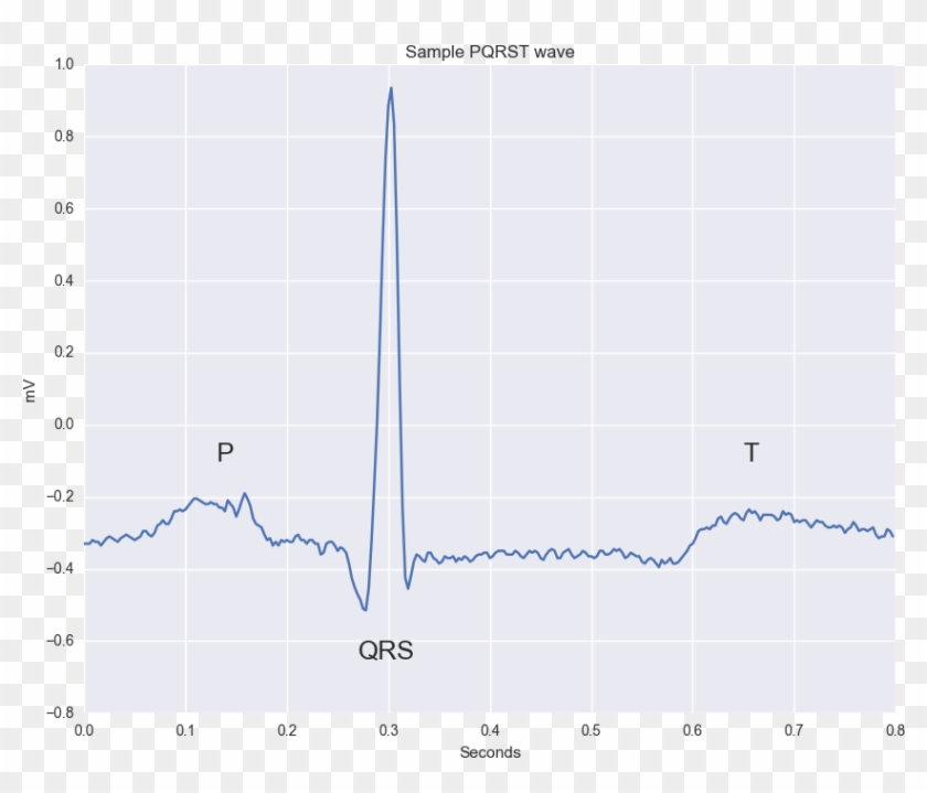 Waveform From An Actual Ecg Recording - Plot Clipart #1723148