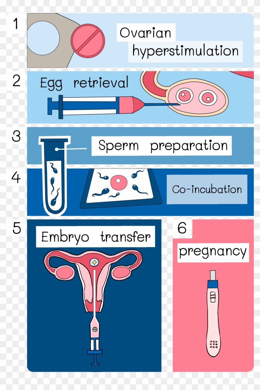 Intracytoplasmic Sperm Injection Clipart #1728101