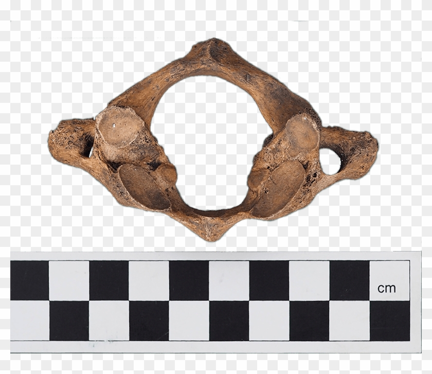 Atlas Vertebra From Graveyard - Wood Clipart #1737940