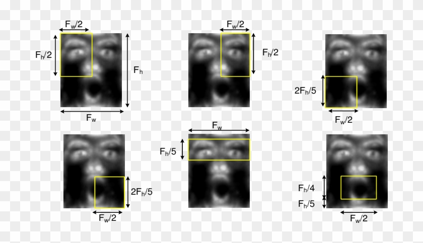 Au Regions Highlighted On A Surprise Gabor Face - Computed Tomography Clipart