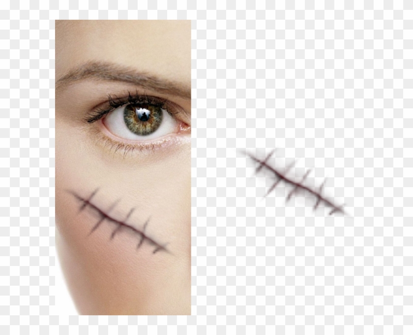 616 X 600 12 - Stitches On Face Png Clipart #1757507