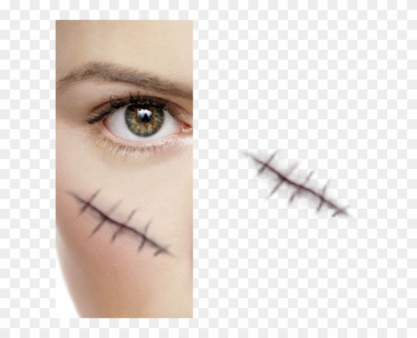 616 X 600 12 - Stitches On Face Png Clipart