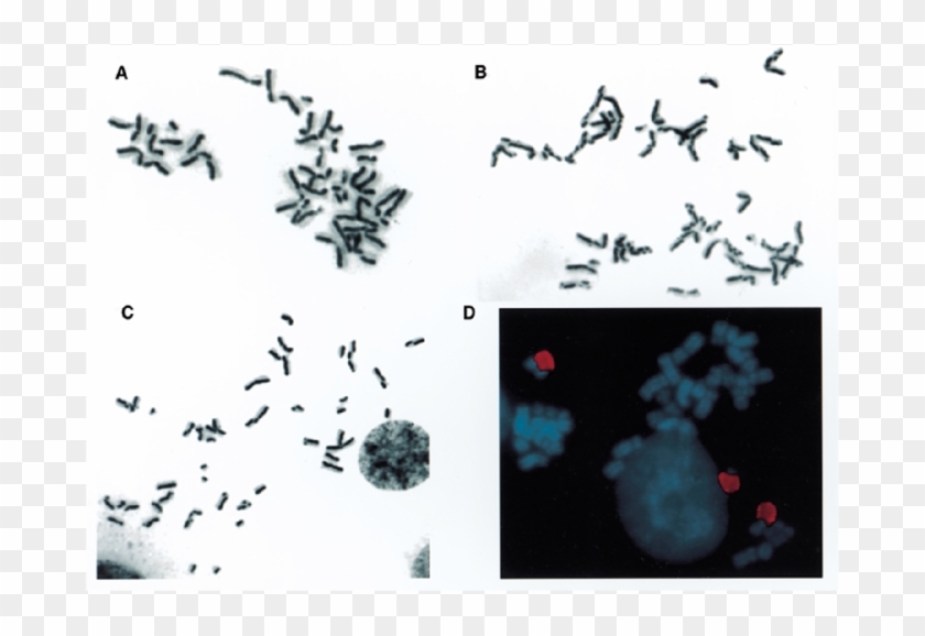 Retention Of Elevated Sce Phenotype In Htert Infected - Visual Arts Clipart #1768895