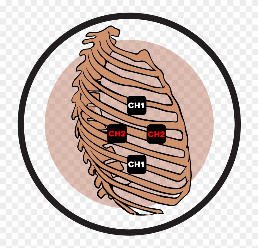 Rib Cage Electrode Pad Placement - Tens Placement For Rib Pain Clipart