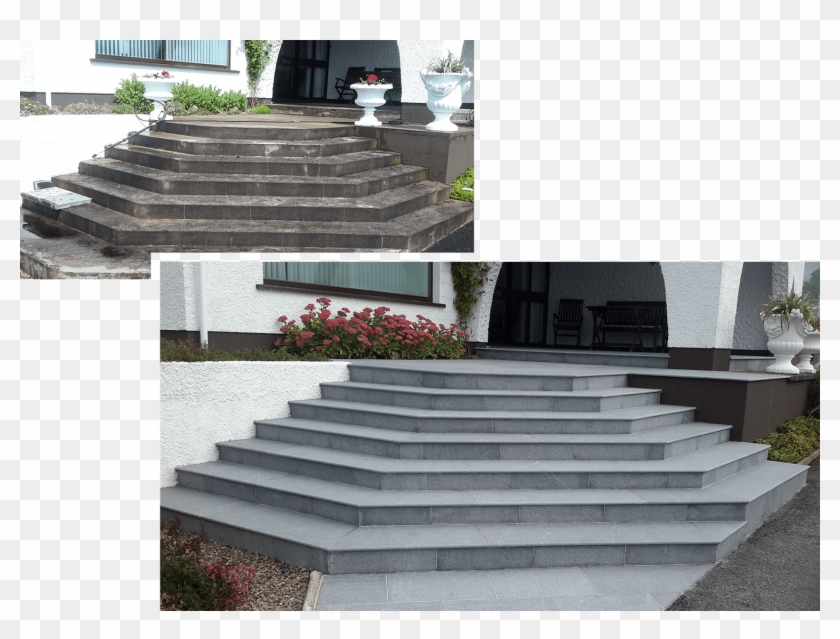 Before After Steps - Steps Png Clipart