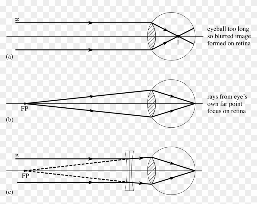 Diagrams Cbse Class Class X Physics Light Reflection - Short Sighted Ray Diagram Clipart