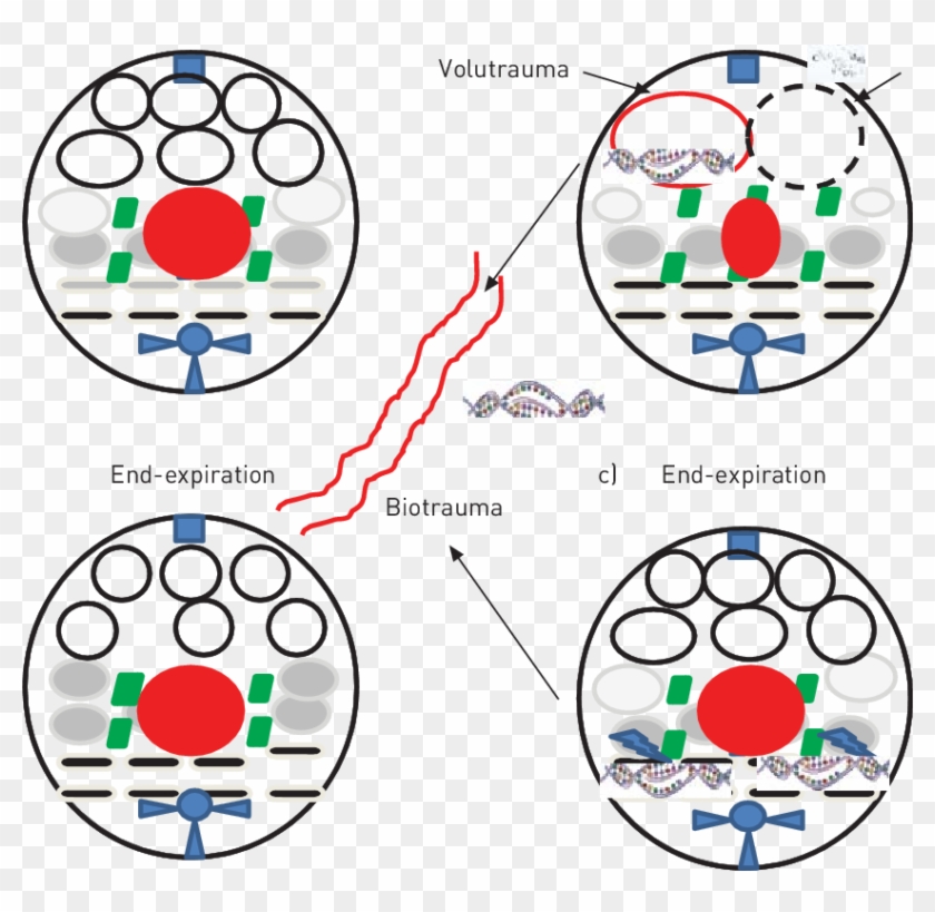 A) The Distribution Of Normally Aerated (white Circles), - Circle Clipart